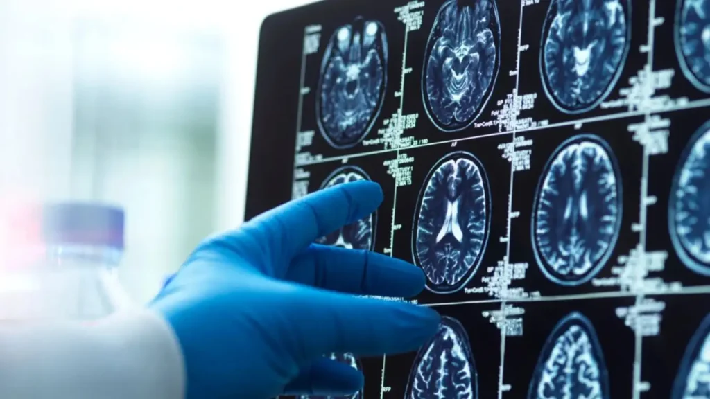 Άνοια: Ανθυγιεινή διατροφή, καθιστική ζωή και λιγότερη αισιοδοξία σχετίζονται με τον αυξημένο κίνδυνο εμφάνισης της νόσου Άνοια: Ανθυγιεινή διατροφή, καθιστική ζωή και λιγότερη αισιοδοξία σχετίζονται με τον αυξημένο κίνδυνο εμφάνισης της νόσου